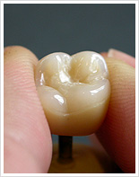 Zahntechnik-Labor Claus Fiderer